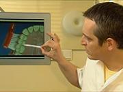 Mezizubní kartáčky - Jak správně používat mezizubní kartáčky - dentálny hygiena 4