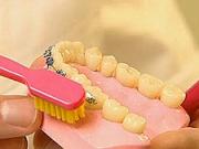 Zubní rovnátka - péče o zuby s rovnátky